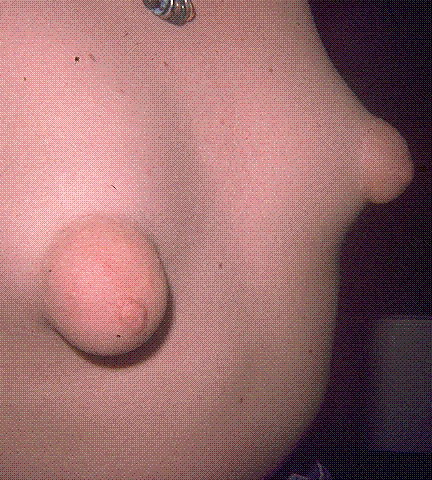 tissit
